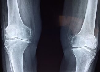 Od jakiego wieku buty ortopedyczne? Od jakiego wieku buty ortopedyczne?